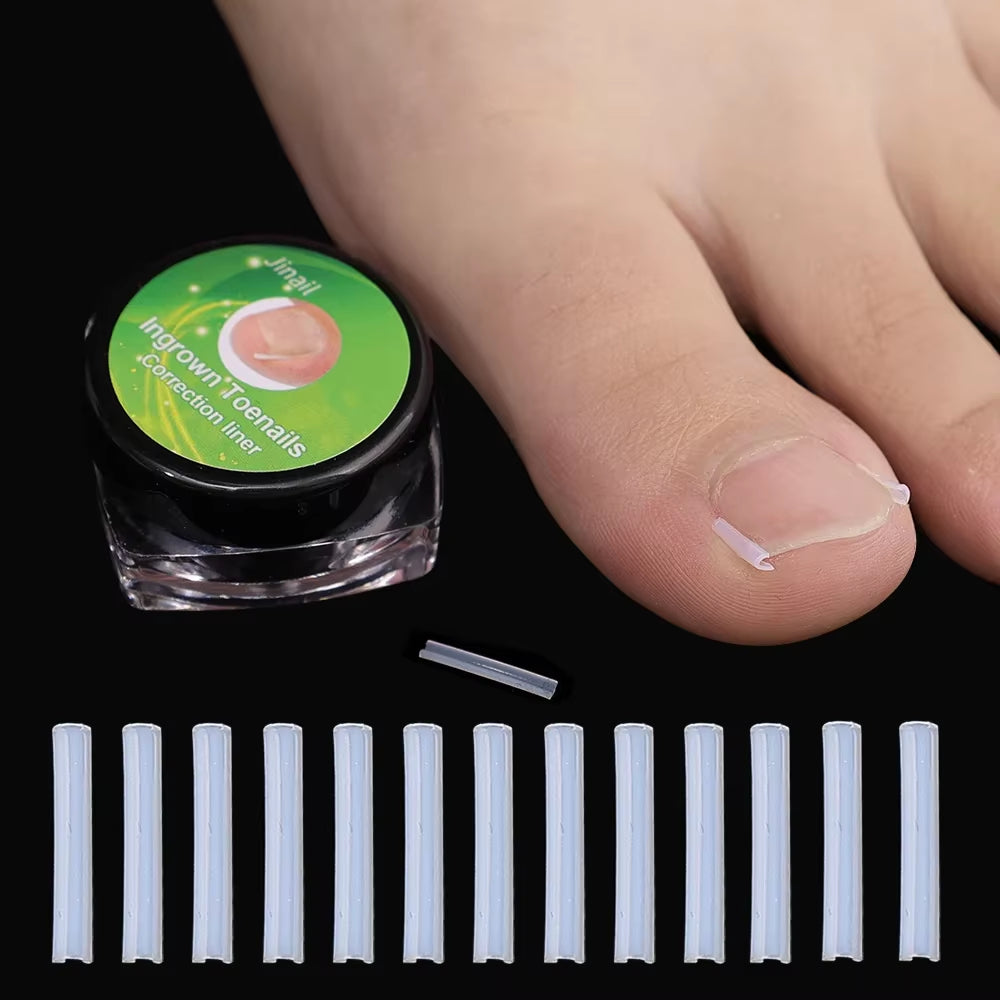 1-100PCS Ingrown Toenail Correction Ultra-Thin Nail Treatment Elastic Patch Sticker Straightening Nails Groove Ingrown Corrector