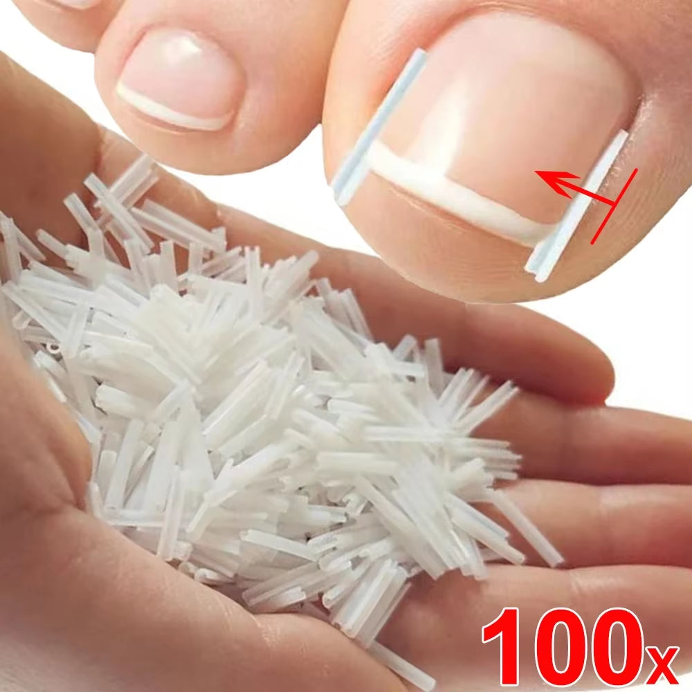 1-100PCS Ingrown Toenail Correction Ultra-Thin Nail Treatment Elastic Patch Sticker Straightening Nails Groove Ingrown Corrector